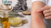 Organic Soothing Balm for Eczema: A 2026 Guide